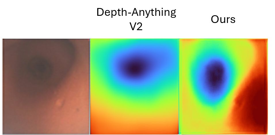 BREA-Depth airway depth illustration