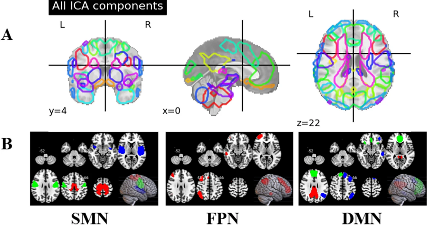 DPD dynamics brain connectivity visualization